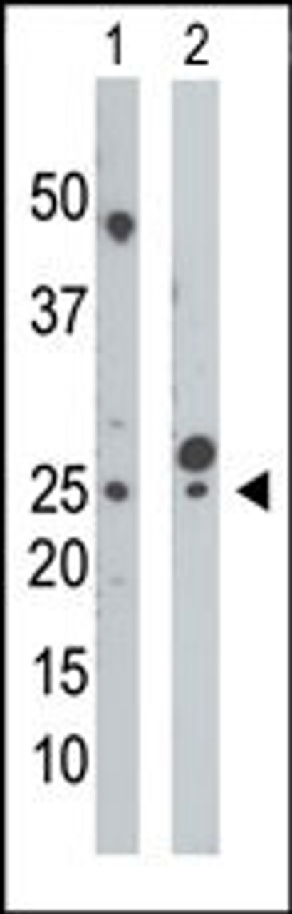 Antibody is used in Western blot to detect UCK in mouse cerebellum tissue lysate (Lane 1) and HepG2 cell lysate (Lane 2) .
