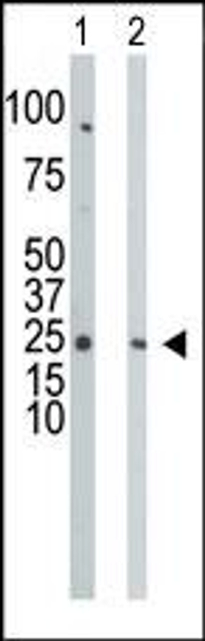 Antibody is used in Western blot to detect UCK in HepG2 cell lysate (Lane 1) and mouse cerebellum tissue lysate (Lane 2) .