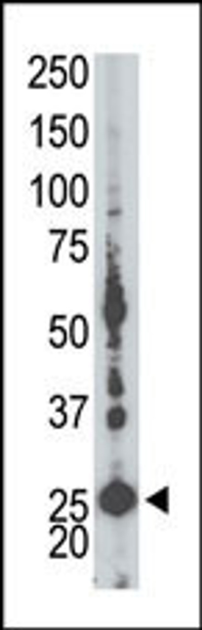 Antibody is used in Western blot to detect AK5 in mouse liver tissue lysate.