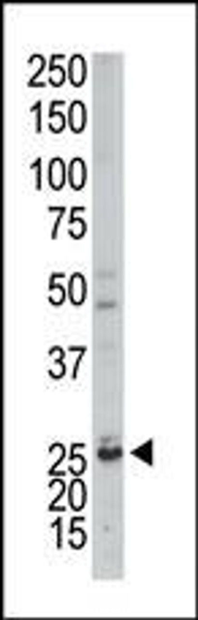 Antibody is used in Western blot to detect AK3 in mouse kidney tissue lysate.