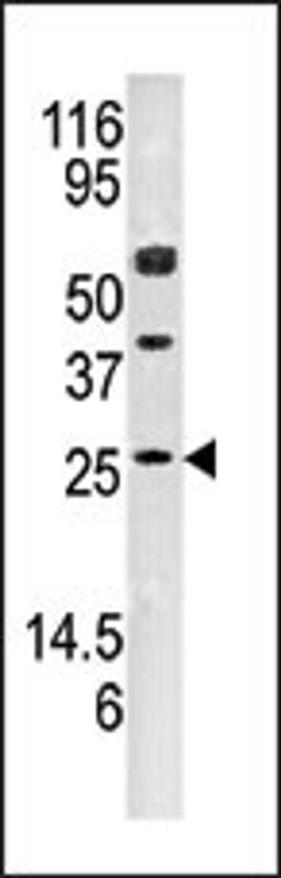 Western blot analysis of anti-AK3 Pab in mouse kidney tissue lysate (35ug/lane)