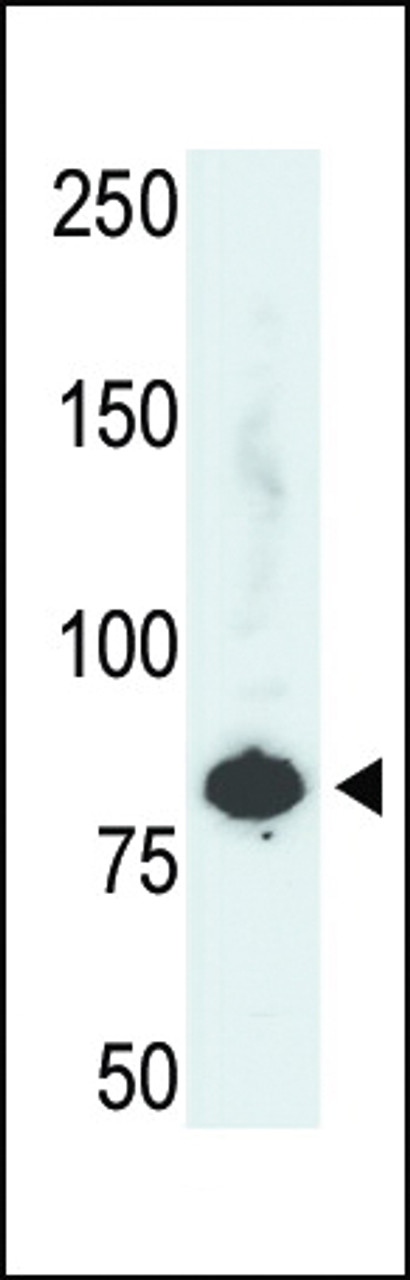 Antibody is used in Western blot to detect PFKL in HepG2 cell lysate.