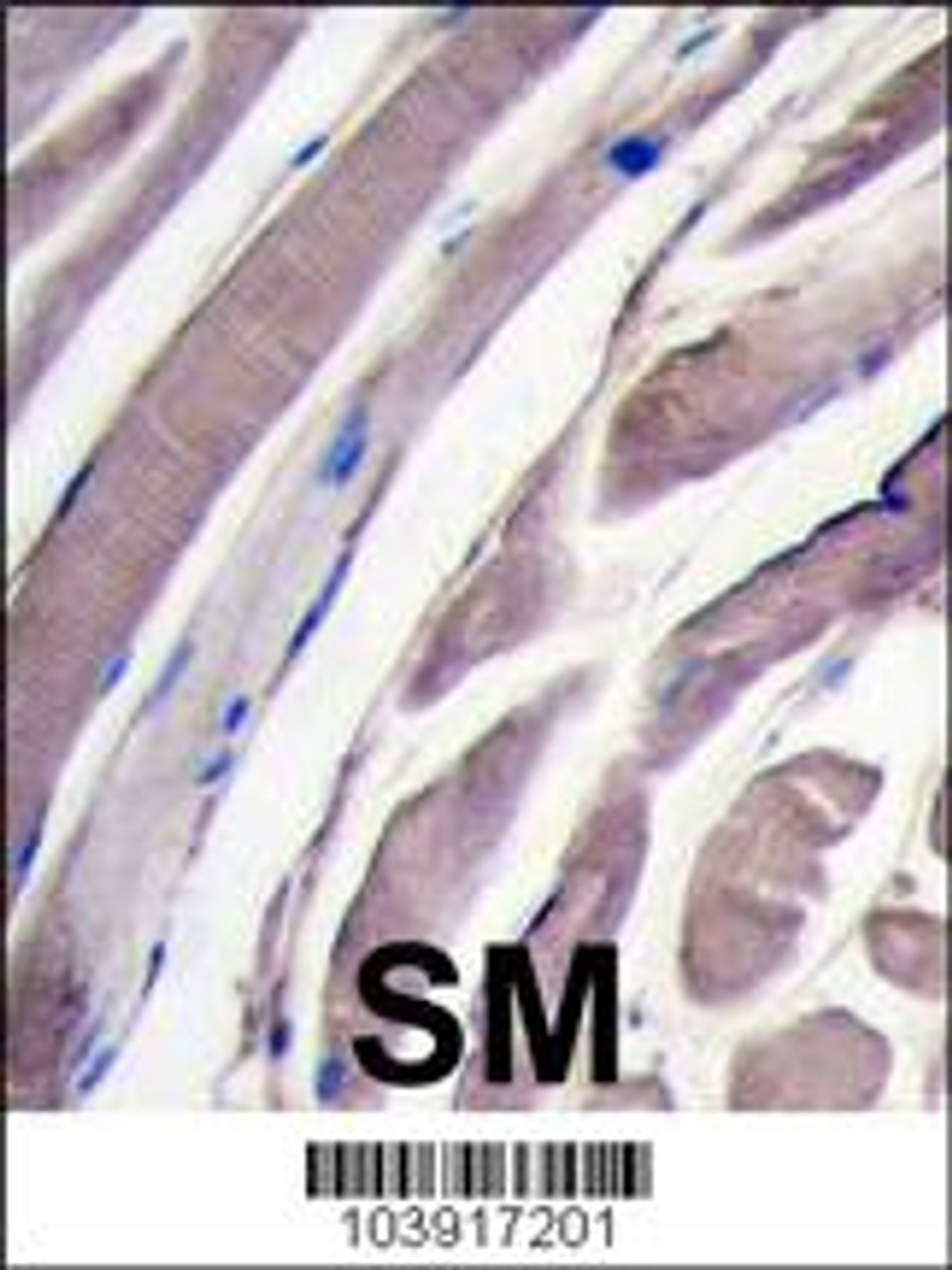 Formalin-fixed and paraffin-embedded human skeletal muscle tissue reacted with HK2 antibody (N-term) , which was peroxidase-conjugated to the secondary antibody, followed by DAB staining.