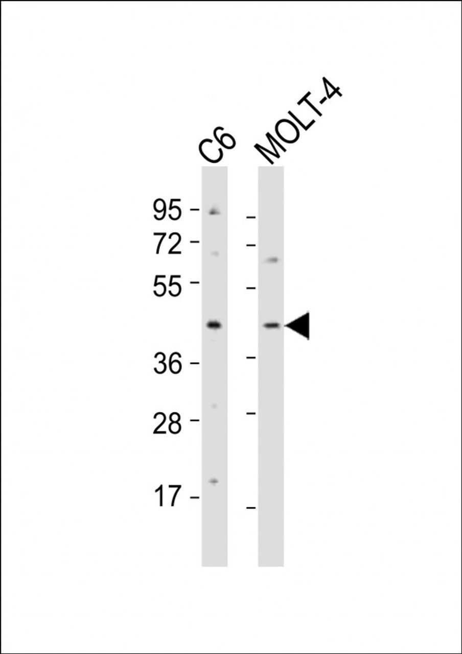 Western Blot at 1:2000 dilution Lane 1: C6 whole cell lysates Lane 2: MOLT-4 whole cell lysates Lysates/proteins at 20 ug per lane.