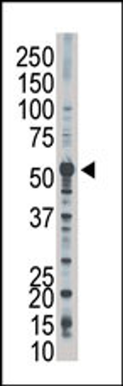 Antibody is used in Western blot to detect PFKFB2 in Jurkat cell lysate.