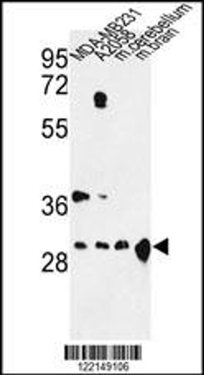 Western blot analysis of YWHAZ Antibody in MDA-MB231, A2058 cell line and mouse cerebellum, brain tissue lysates (35ug/lane)