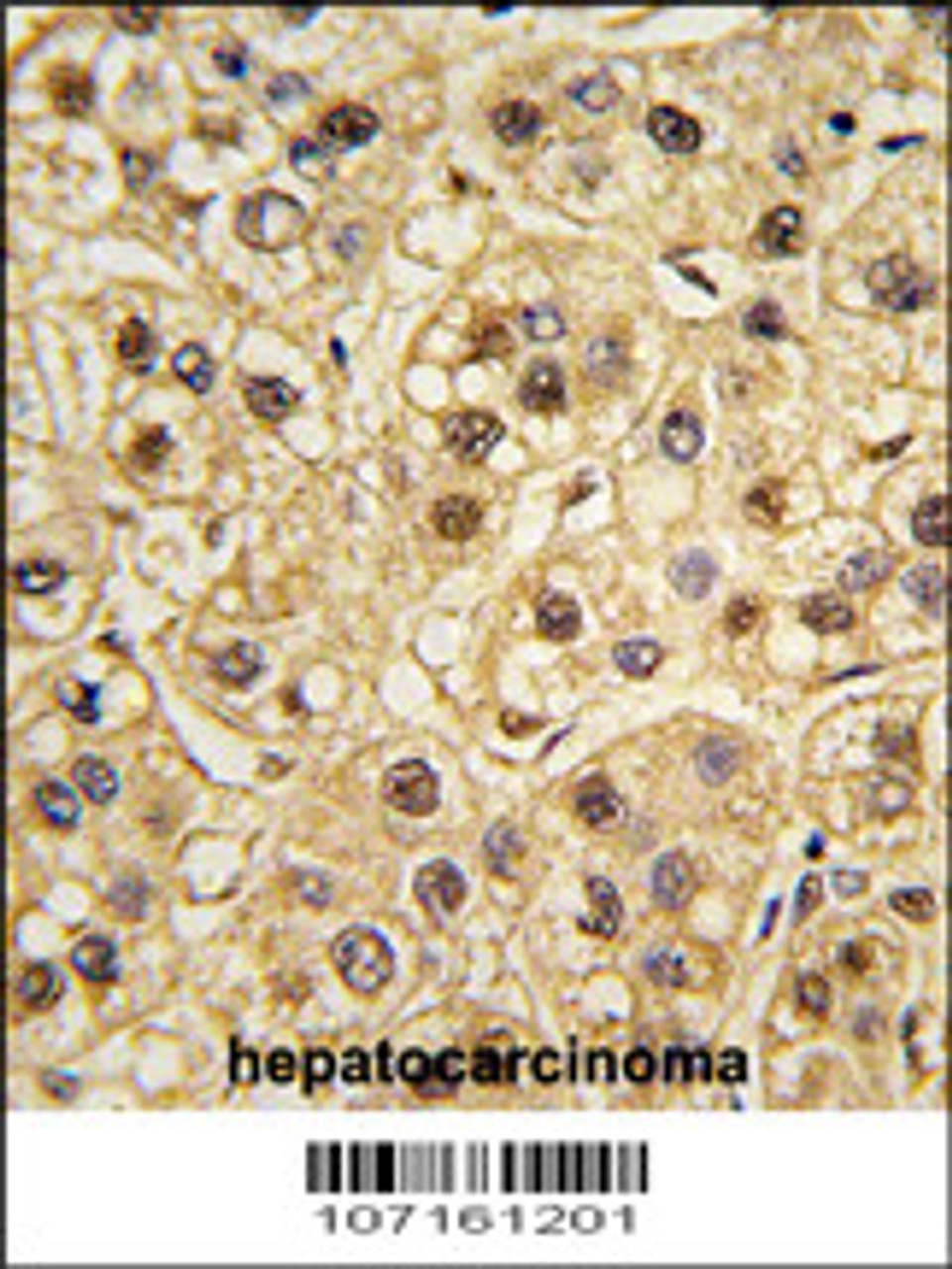 Formalin-fixed and paraffin-embedded human testis tissue reacted with YWHAZ Antibody, which was peroxidase-conjugated to the secondary antibody, followed by DAB staining.