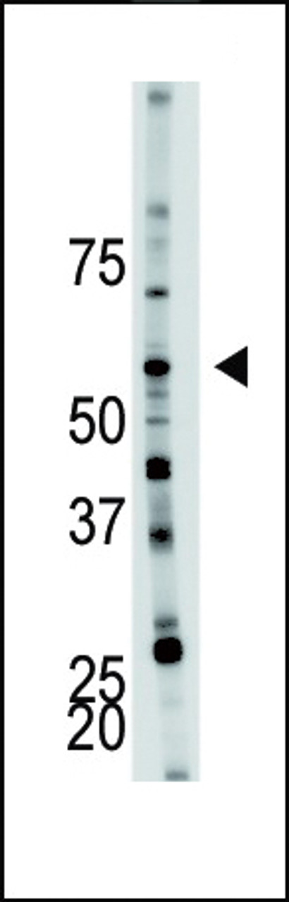 Antibody is used in Western blot to detect PFKFB4 in mouse brain tissue lysate.