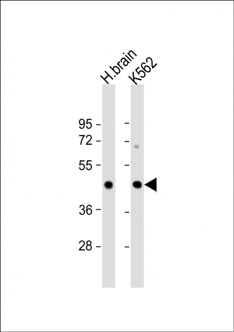Western Blot at 1:1000 dilution Lane 1: human brain lysate Lane 2: K562 whole cell lysate Lysates/proteins at 20 ug per lane.