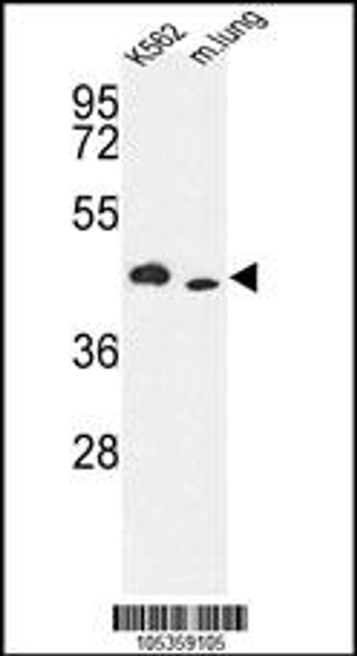 Western blot analysis of hITPKA-E360 in K562 cell line and mouse lung tissue lysates (35ug/lane)