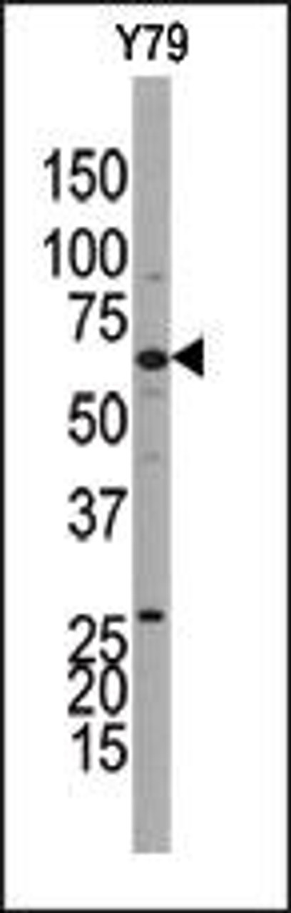 Western blot analysis of anti-GUCY1B3 Pab (AP8171b) in Y79 cell line lysate.