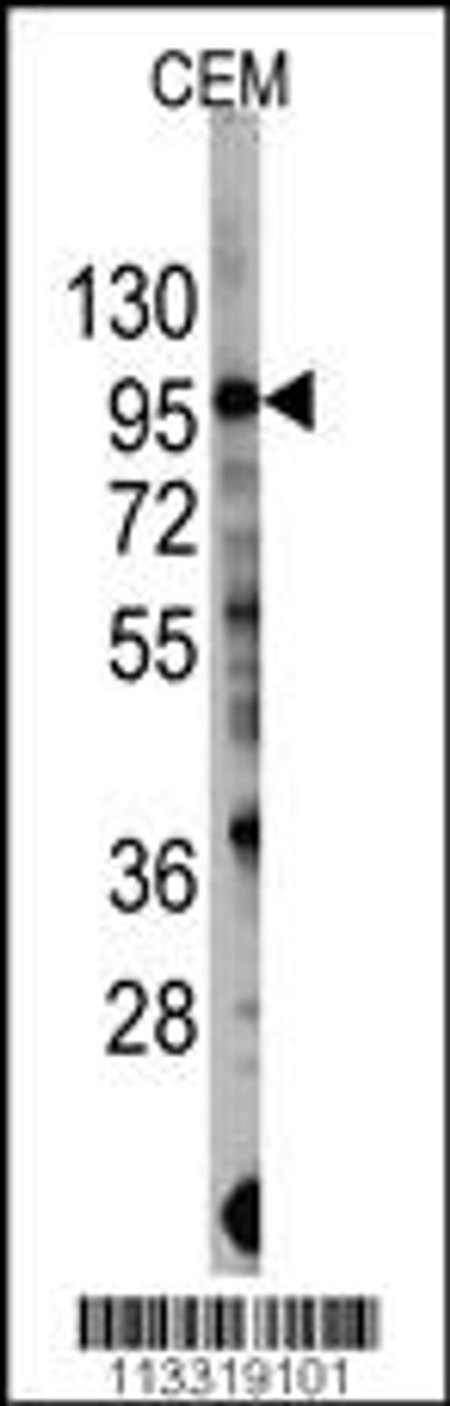 Western blot analysis of anti-PIK3CG Antibody (S1100) in CEM cell line lysates (35ug/lane) .