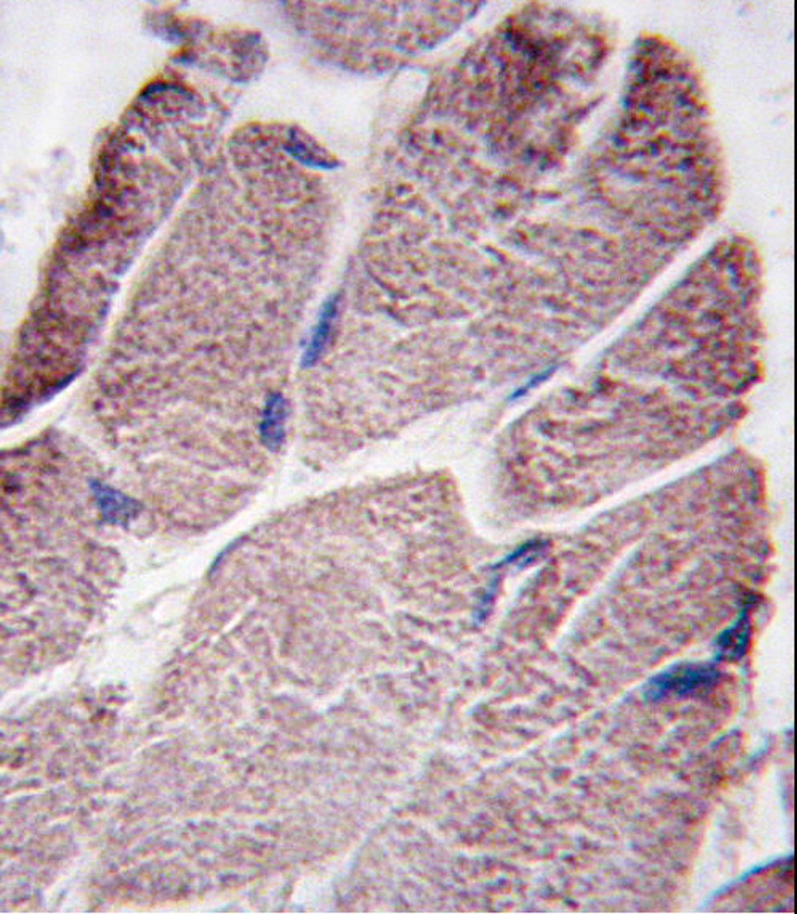 Formalin-fixed and paraffin-embedded human skeletal muscle tissue reacted with PTPD1 antibody, which was peroxidase-conjugated to the secondary antibody, followed by DAB staining.