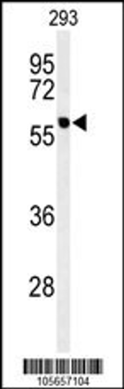 Western blot analysis of hPPM1G-C164 in 293 cell line lysates (35ug/lane)
