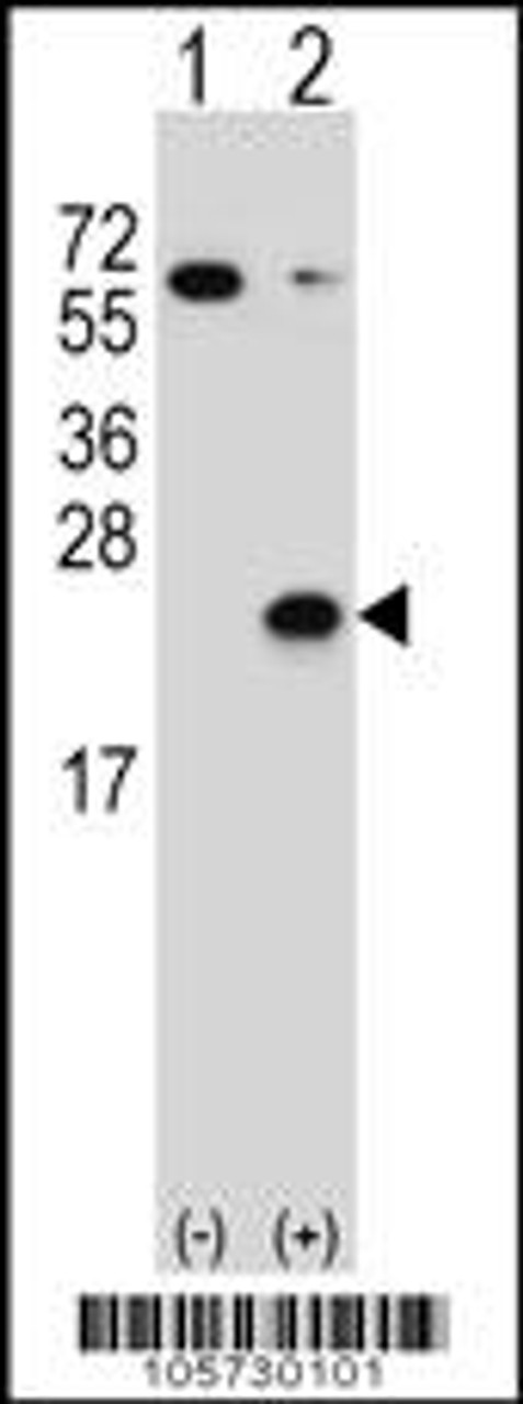 Western blot analysis of DUSP3 using rabbit polyclonal DUSP3 Antibody (C171) using 293 cell lysates (2 ug/lane) either nontransfected (Lane 1) or transiently transfected (Lane 2) with the DUSP3 gene.