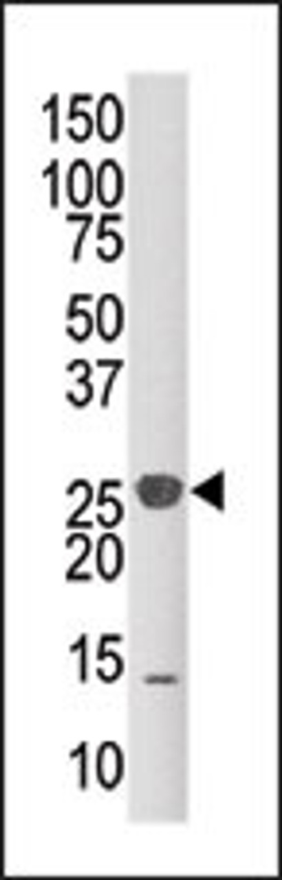 Western blot analysis of anti-DUSP14 Pab in mouse kidney tissue lysate (35ug/lane) .