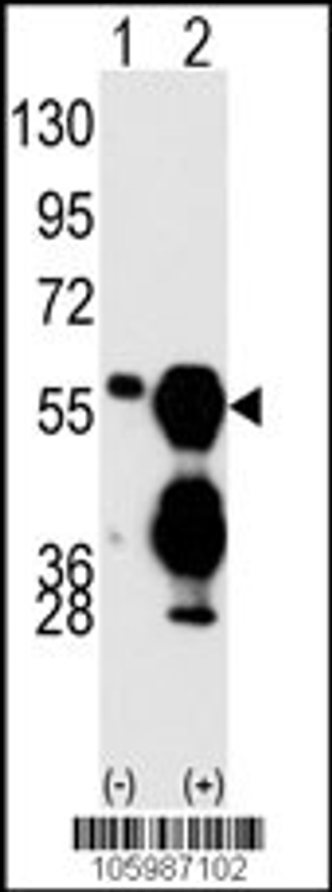 Western blot analysis of PPM1F using PPM1F Antibody using 293 cell lysates (2 ug/lane) either nontransfected (Lane 1) or transiently transfected with the PPM1F gene (Lane 2) .
