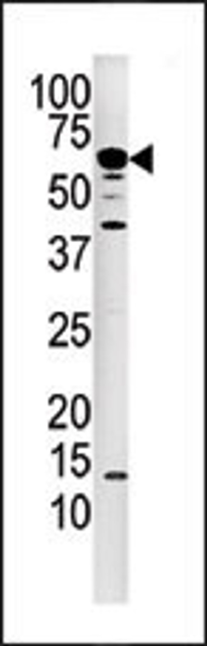 Western blot analysis of anti-PPP3CA Pab in mouse kidney tissue lysate.