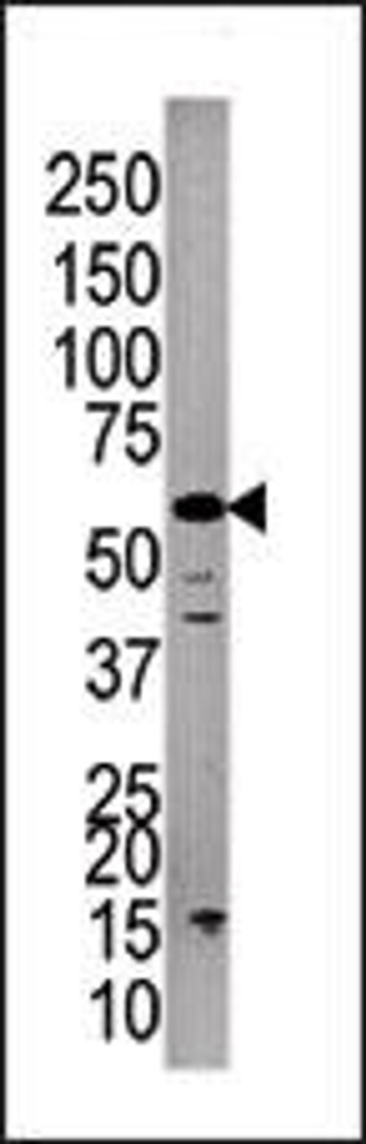 Western blot analysis of anti-PPP3CC Pab in A375cell line lysate.