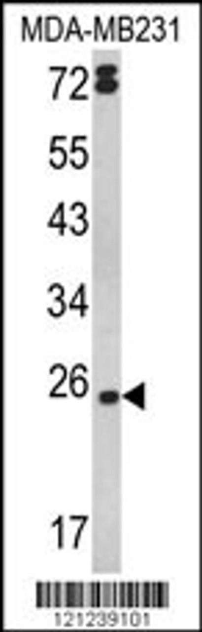 Western blot analysis of LTA Antibody in MDA-MB231 cell line lysates (35ug/lane)