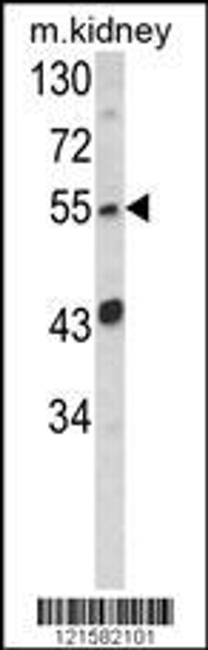 Western blot analysis of SIL1 Antibody in mouse kidney tissue lysates (35ug/lane)