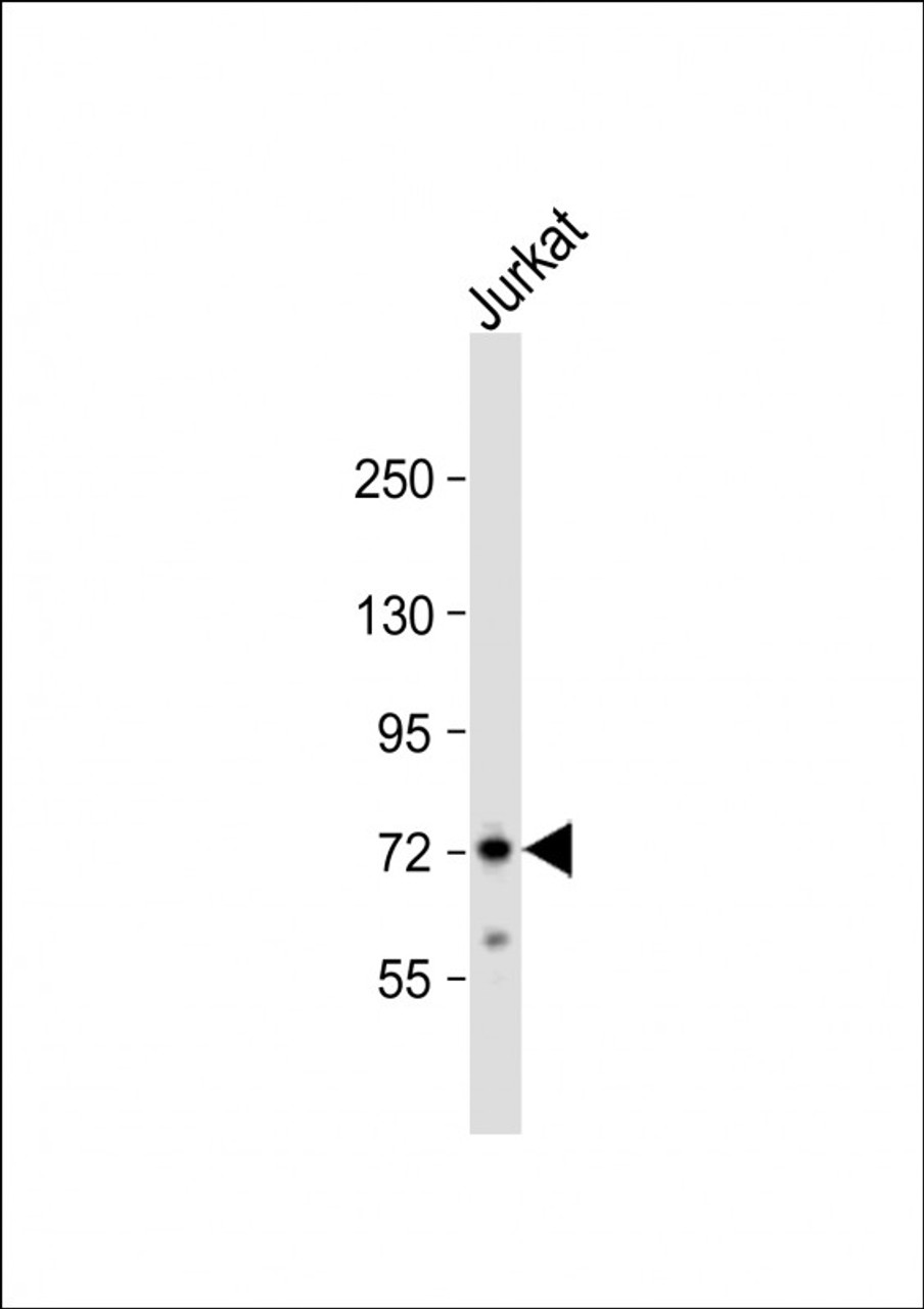 Western Blot at 1:1000 dilution + Jurkat whole cell lysate Lysates/proteins at 20 ug per lane.