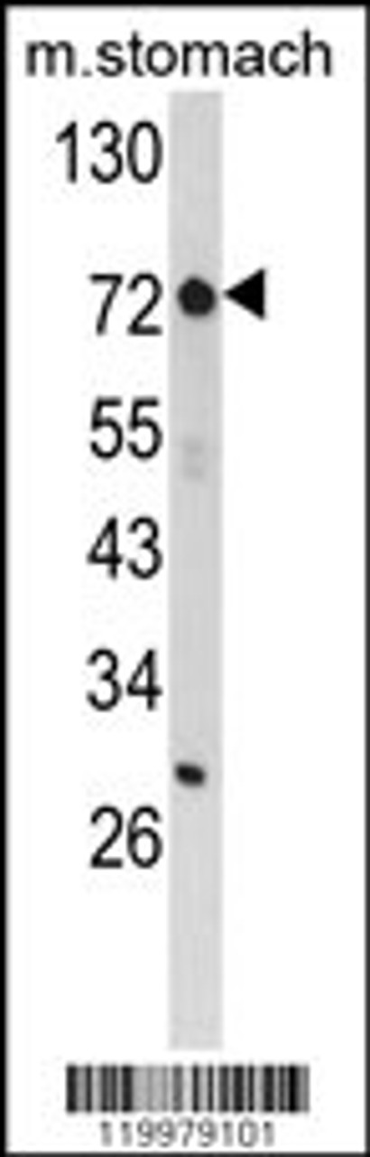 Western blot analysis of ZFP36 Antibody in mouse stomach tissue lysates (35ug/lane) (8ug/ml)