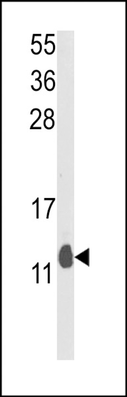 Western blot analysis of PEA-15 Antibody in mouse lung tissue lysates (35ug/lane)