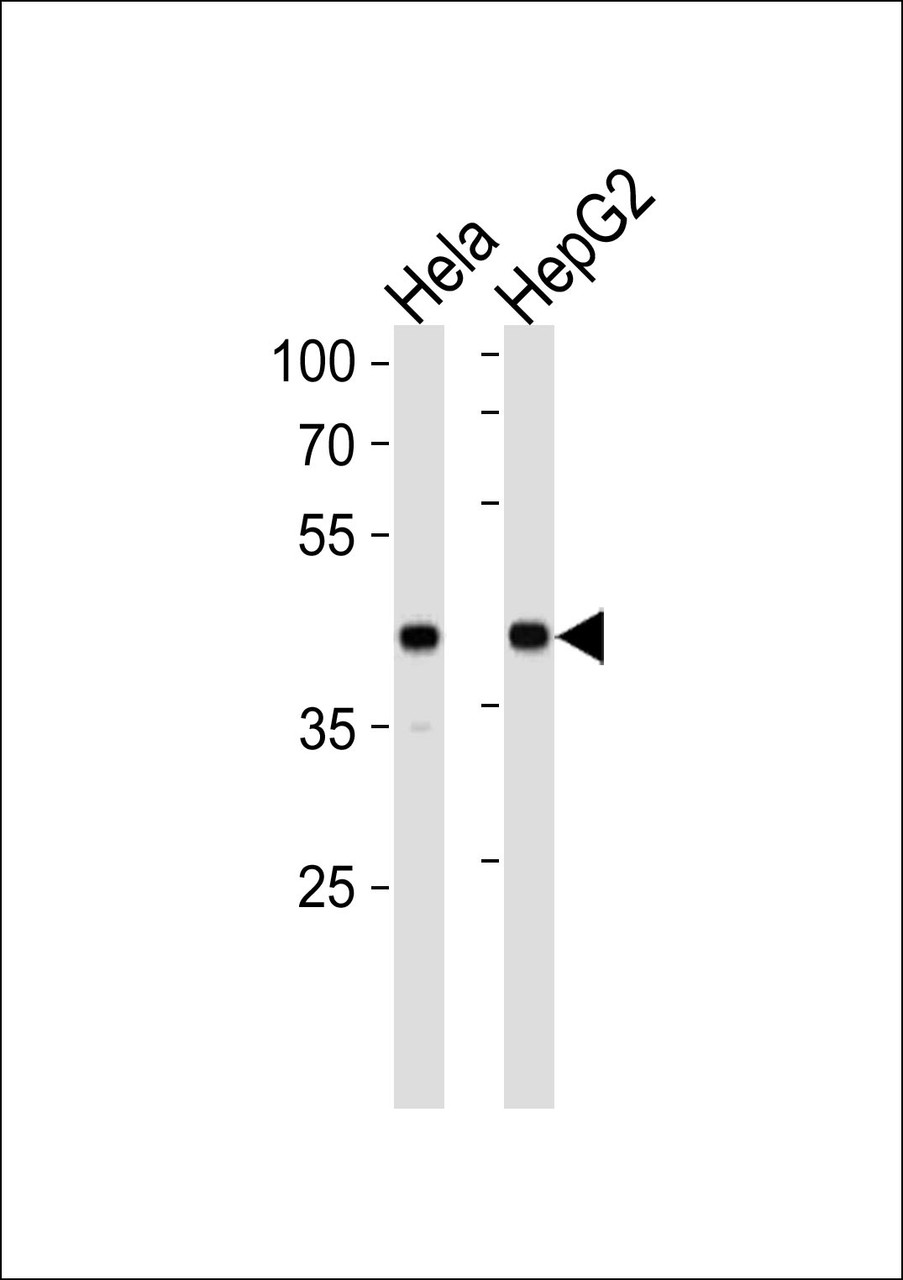 Western blot analysis in Hela, HepG2 cell line lysates (35ug/lane) .