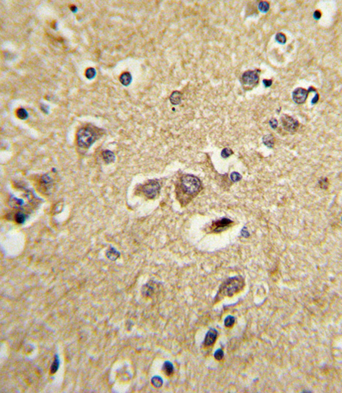 Formalin-fixed and paraffin-embedded human brain tissue with LRPAP1 Antibody, which was peroxidase-conjugated to the secondary antibody, followed by DAB staining.