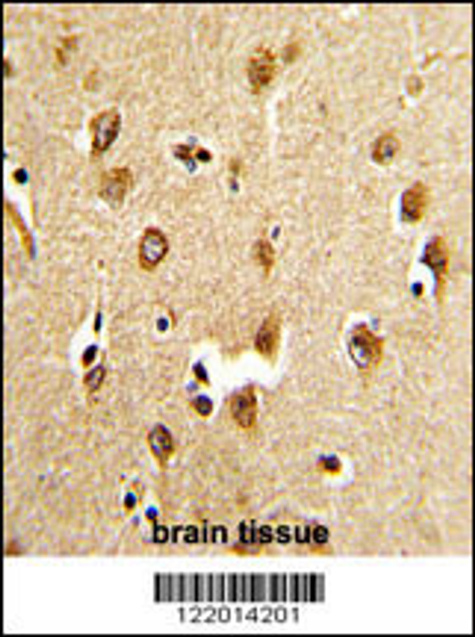Formalin-fixed and paraffin-embedded human brain tissue reacted with ABI1 Antibody (N-term) , which was peroxidase-conjugated to the secondary antibody, followed by DAB staining.
