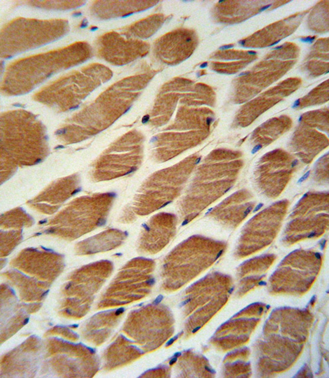 ACADL Antibody immunohistochemistry analysis in formalin fixed and paraffin embedded human skeletal muscle followed by peroxidase conjugation of the secondary antibody and DAB staining.