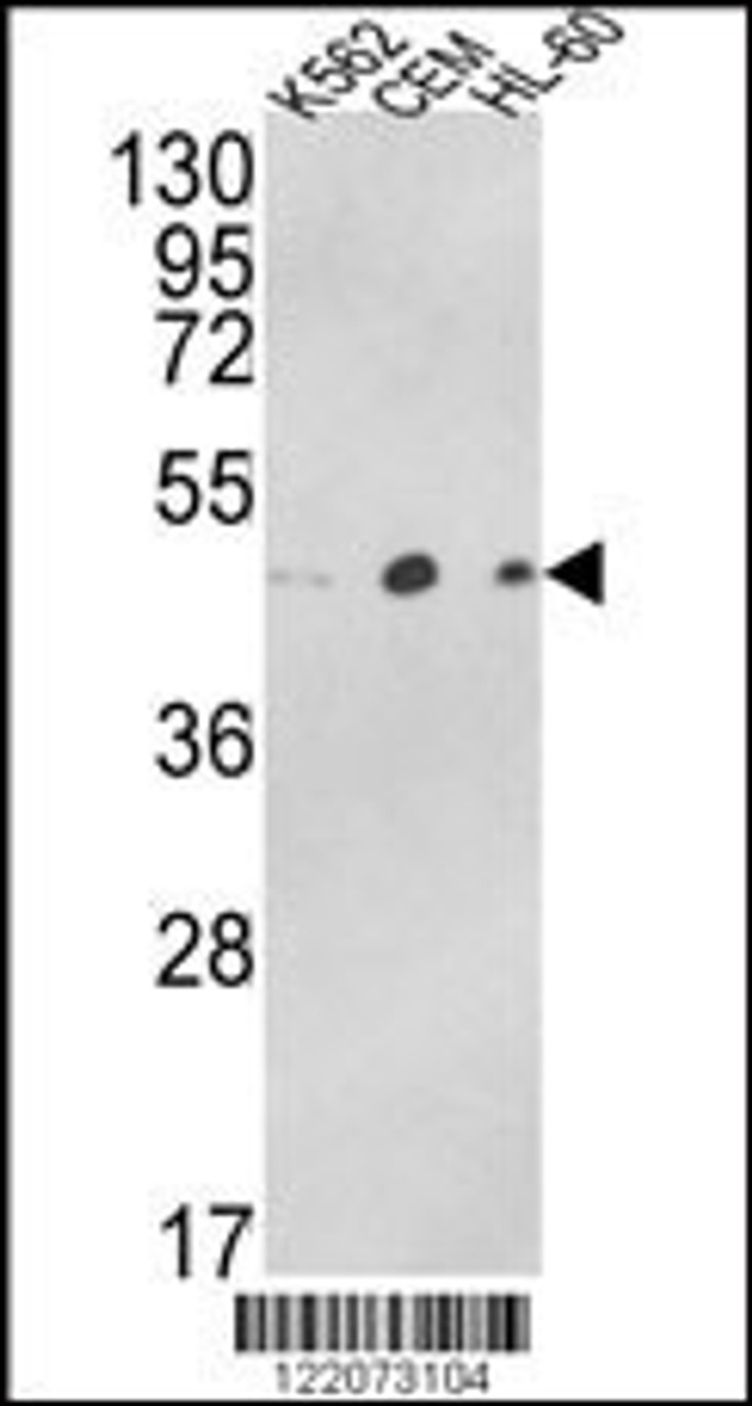 Western blot analysis of ACTR3B Antibody in K562, CEM, HL-60 cell line lysates (35ug/lane)