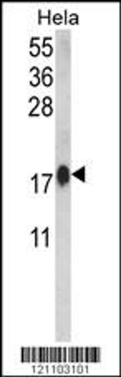 Western blot analysis of CALM1 Antibody in Hela cell line lysates (35ug/lane) (2ug/ml)