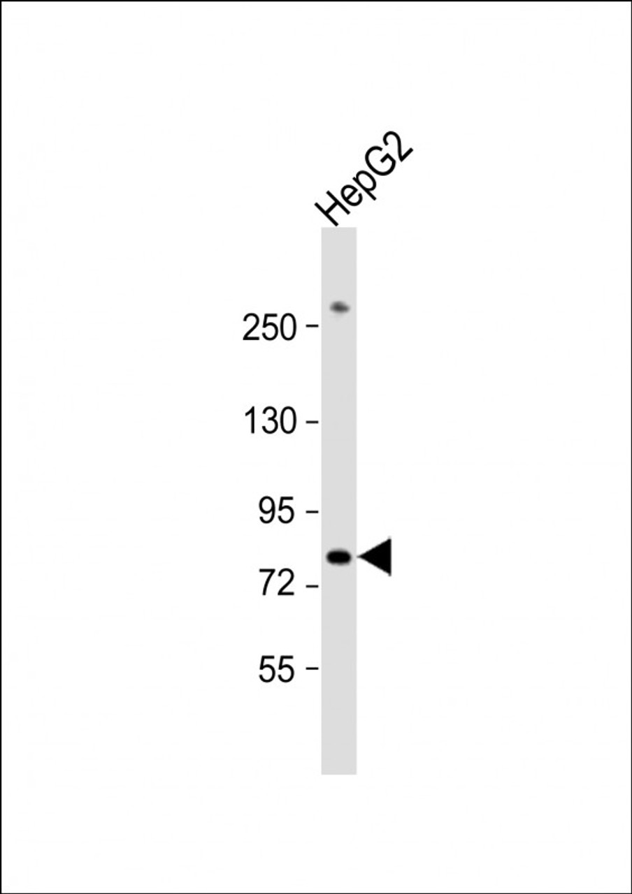 Western Blot at 1:1000 dilution + HepG2 whole cell lysate Lysates/proteins at 20 ug per lane.