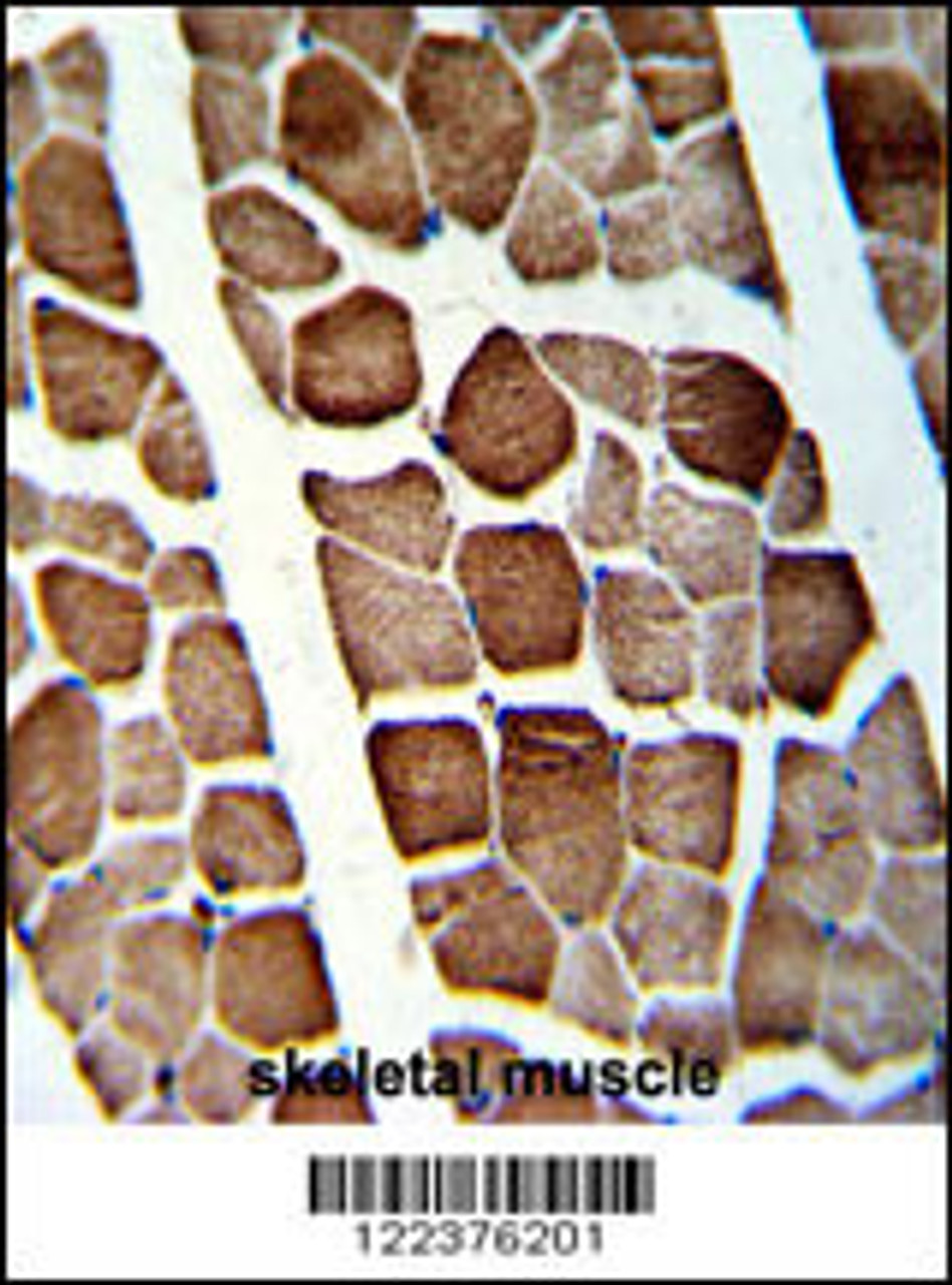Formalin-fixed and paraffin-embedded human skeletal muscle with ATP5O Antibody (N-term) , which was peroxidase-conjugated to the secondary antibody, followed by DAB staining.