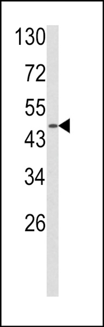 Western blot analysis of ADRA2B Antibody in MDA-MB231 cell line lysates (35ug/lane)