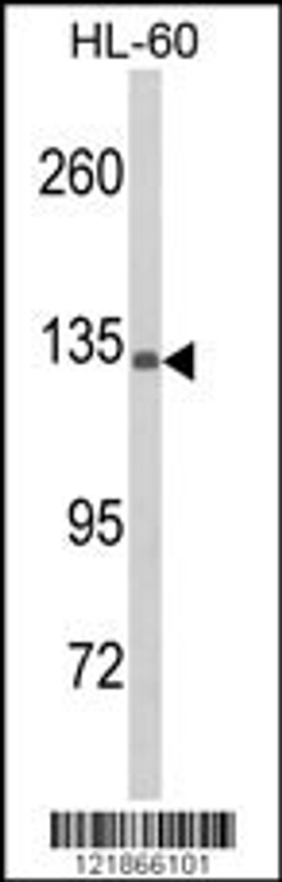 Western blot analysis of C5 Antibody in HL-60 cell line lysates (35ug/lane) (2ug/ml)