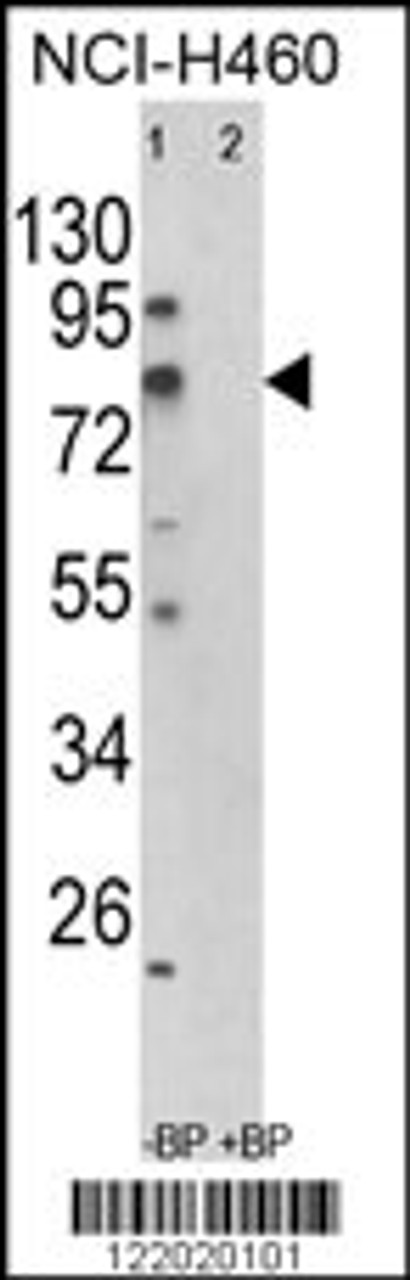 Western blot analysis of ACSS3 Antibody in NCI-H460 cell line lysates (35ug/lane) (2ug/ml)