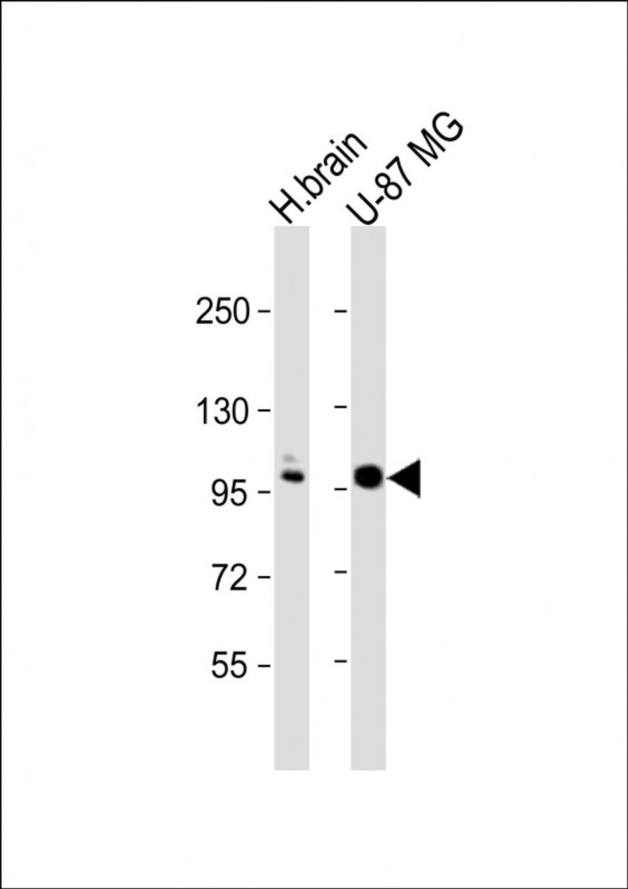 Western Blot at 1:1000 dilution Lane 1: human brain lysate Lane 2: U-87 MG whole cell lysate Lysates/proteins at 20 ug per lane.