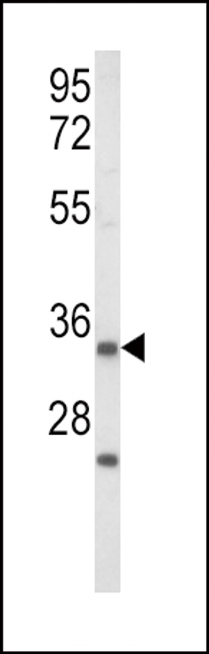 Western blot analysis of IGFBP2 Antibody in Jurkat cell line lysates (35ug/lane) (2ug/ml)
