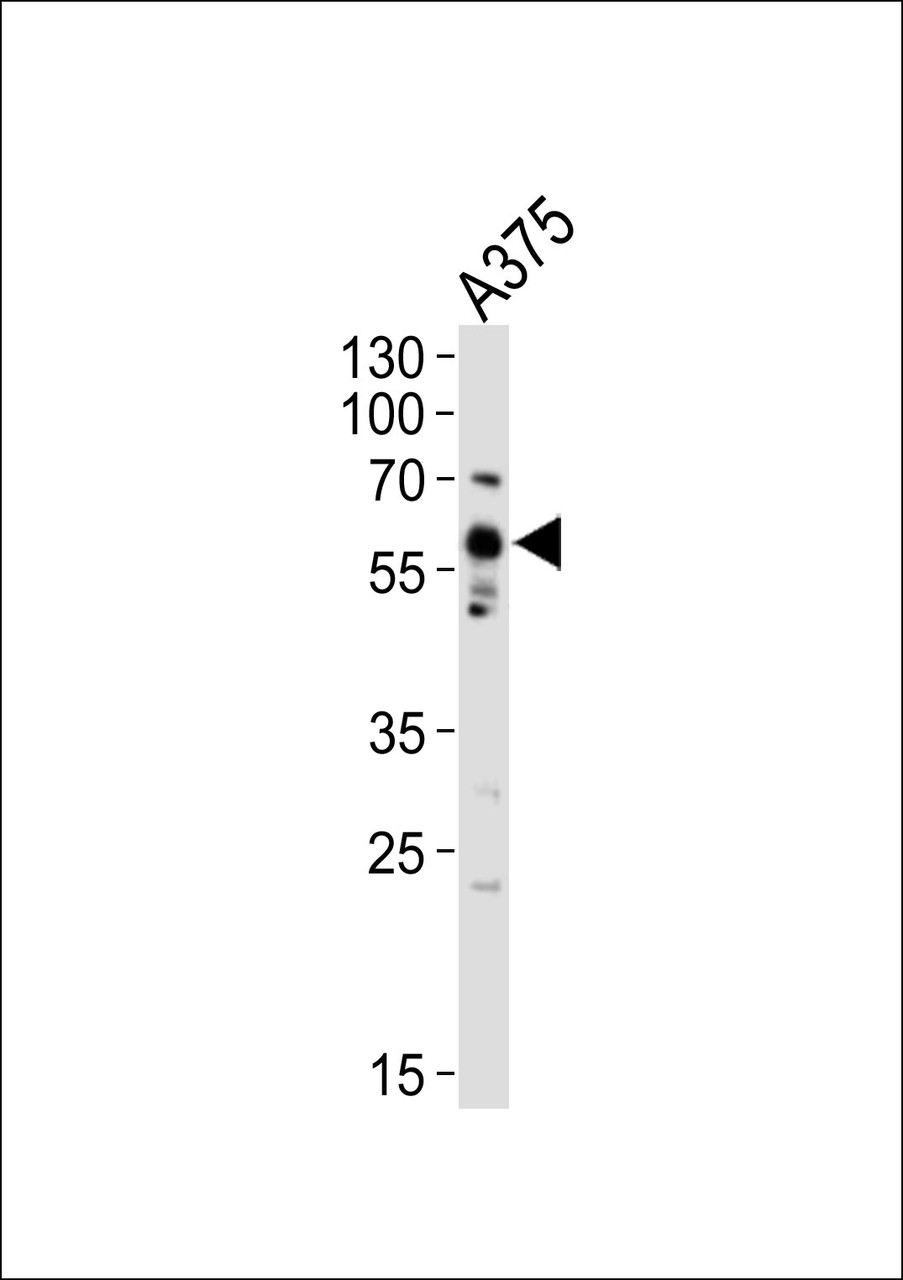Western blot analysis of lysate from A375 cell line, using SRC Antibody (Y419) at 1:1000.