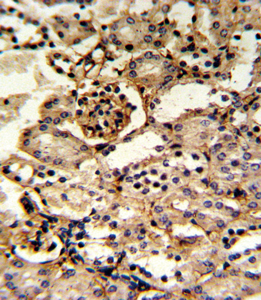 Formalin-fixed and paraffin-embedded kidney tissue reacted with GMPS Antibody, which was peroxidase-conjugated to the secondary antibody, followed by DAB staining.