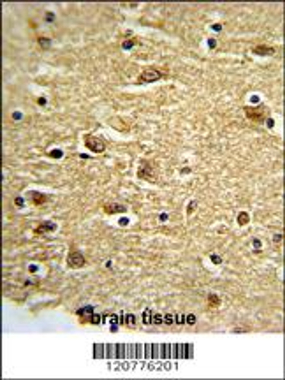 Formalin-fixed and paraffin-embedded human brain tissue reacted with PTK2 Antibody, which was peroxidase-conjugated to the secondary antibody, followed by DAB staining.