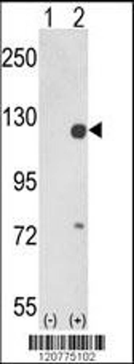 Western blot analysis of PTK2 using rabbit polyclonal PTK2 Antibody using 293 cell lysates (2 ug/lane) either nontransfected (Lane 1) or transiently transfected with the PTK2 gene (Lane 2) .