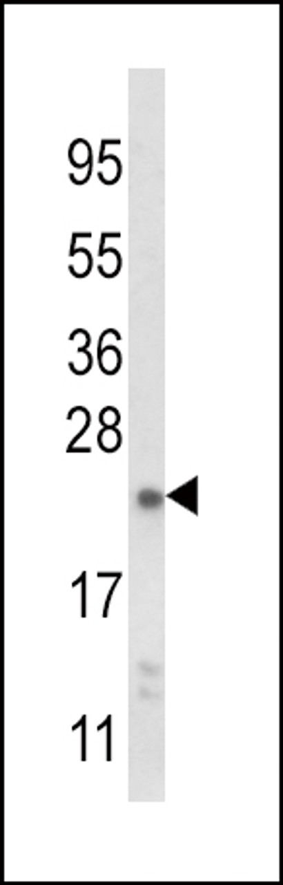 Western blot analysis of NQO2 Antibody in mouse liver tissue lysates (35ug/lane)