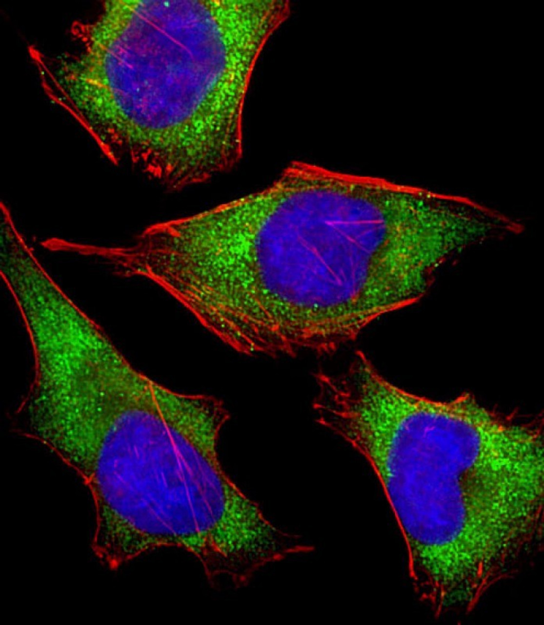 Immunofluorescent analysis of 4% paraformaldehyde-fixed, 0. 1% Triton X-100 permeabilized HeLa (human cervical epithelial adenocarcinoma cell line) cells labeling Pdx1 with antibody at 1/25 dilution, followed by Dylight 488-conjugated goat anti-rabbit IgG (NK179883) secondary antibody at 1/200 dilution (green) . Immunofluorescence image showing cytoplasm staining on HeLa cell line. Cytoplasmic actin is detected with Dylight 554 Phalloidin (PD18466410) at 1/100 dilution (red) . The nuclear counter stain is DAPI (blue) .