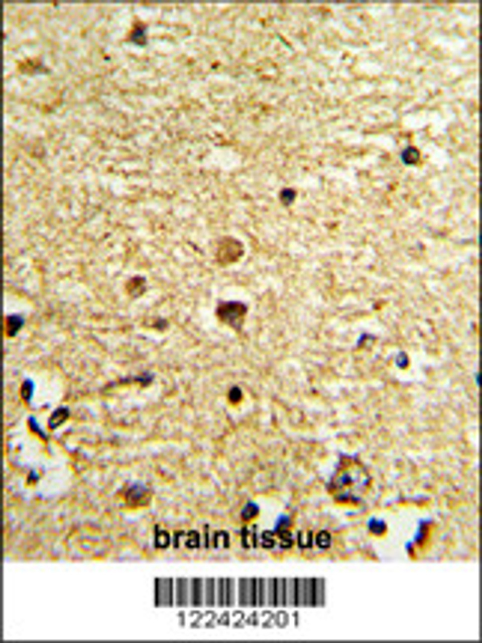Formalin-fixed and paraffin-embedded human brain tissue with OLIG3 Antibody, which was peroxidase-conjugated to the secondary antibody, followed by DAB staining.