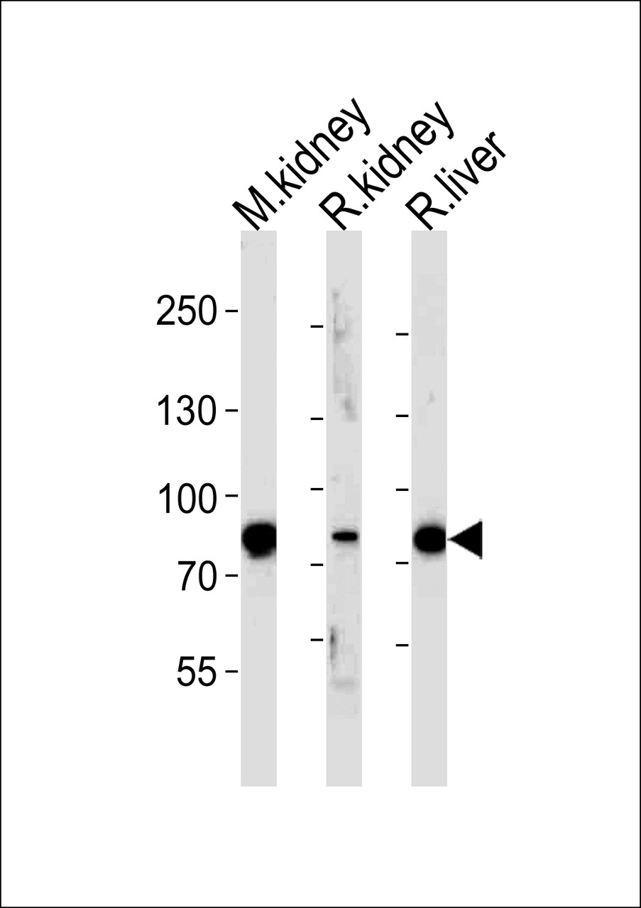 Western blot analysis of lysates from mousr kidney, rat kidney and liver tissue (from left to right) , using EHHADH Antibody at 1:1000 at each lane.