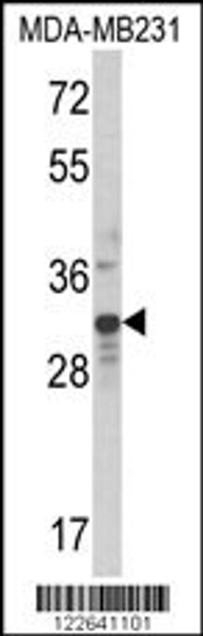 Western blot analysis of MLX Antibody in MDA-MB231 cell line lysates (35ug/lane)